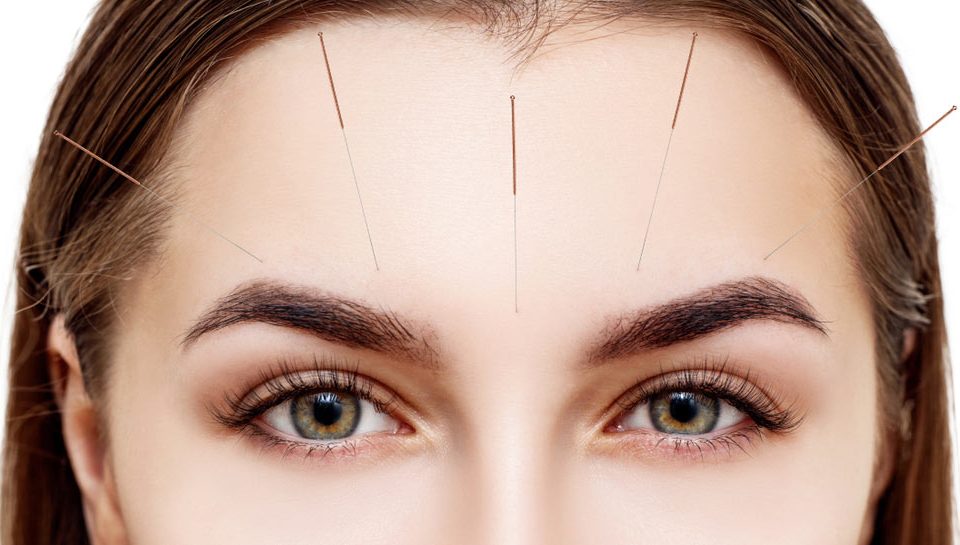 5 Reasons Why the Summer Is the Perfect Time to Start Your Acupuncture Sessions w