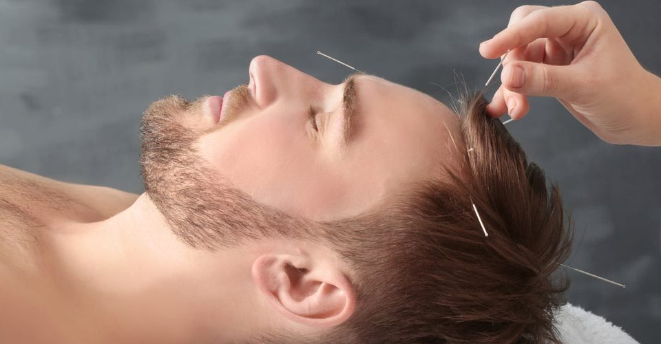 Male Fertility Acupuncture